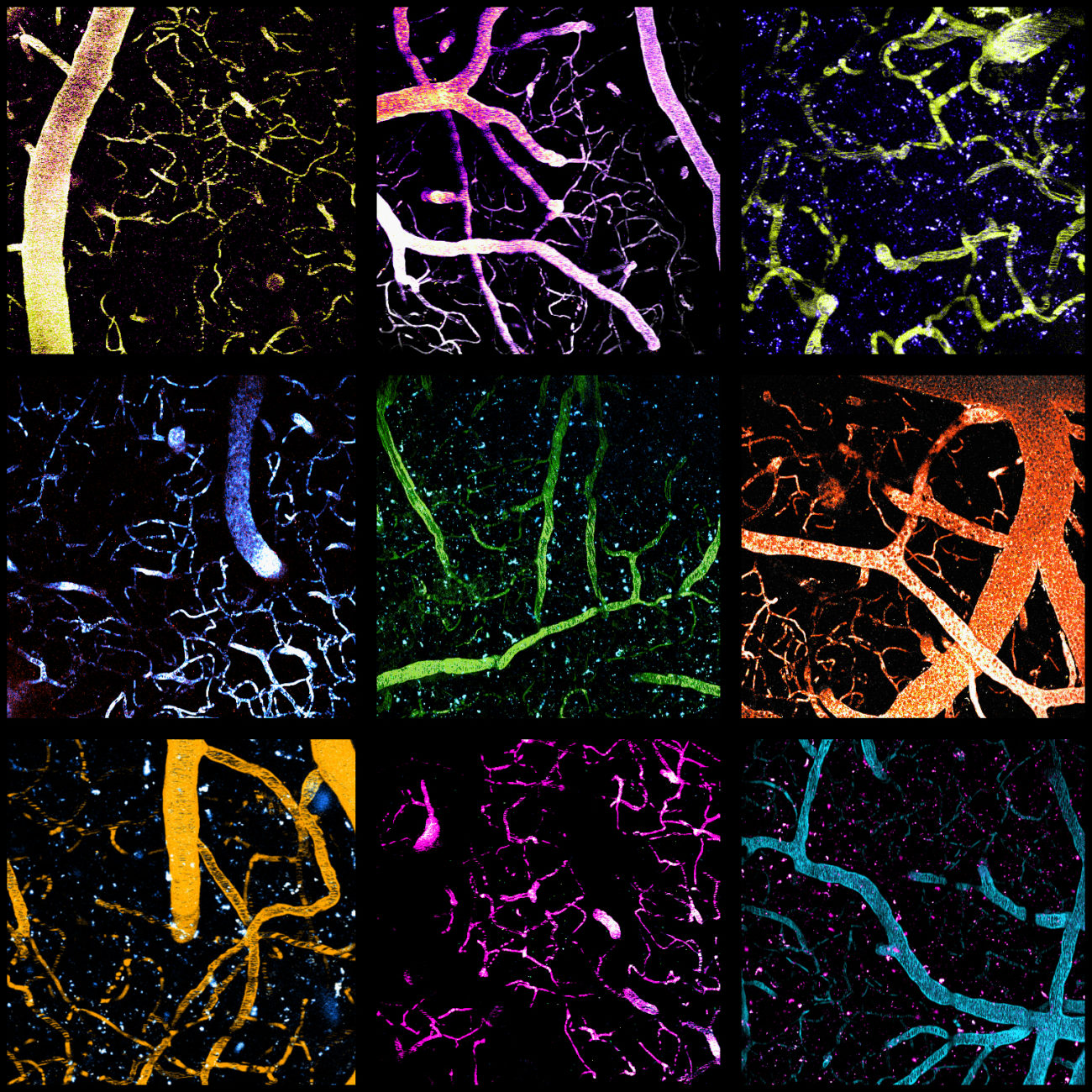 Nanoparticles travel through the vascular beds in the brain.